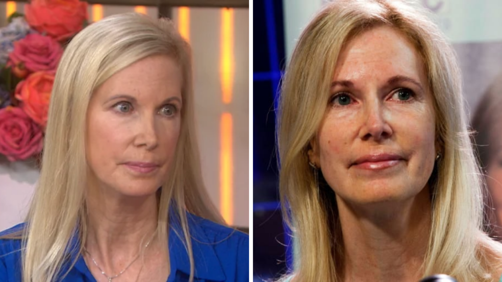 beth holloway plastic surgery