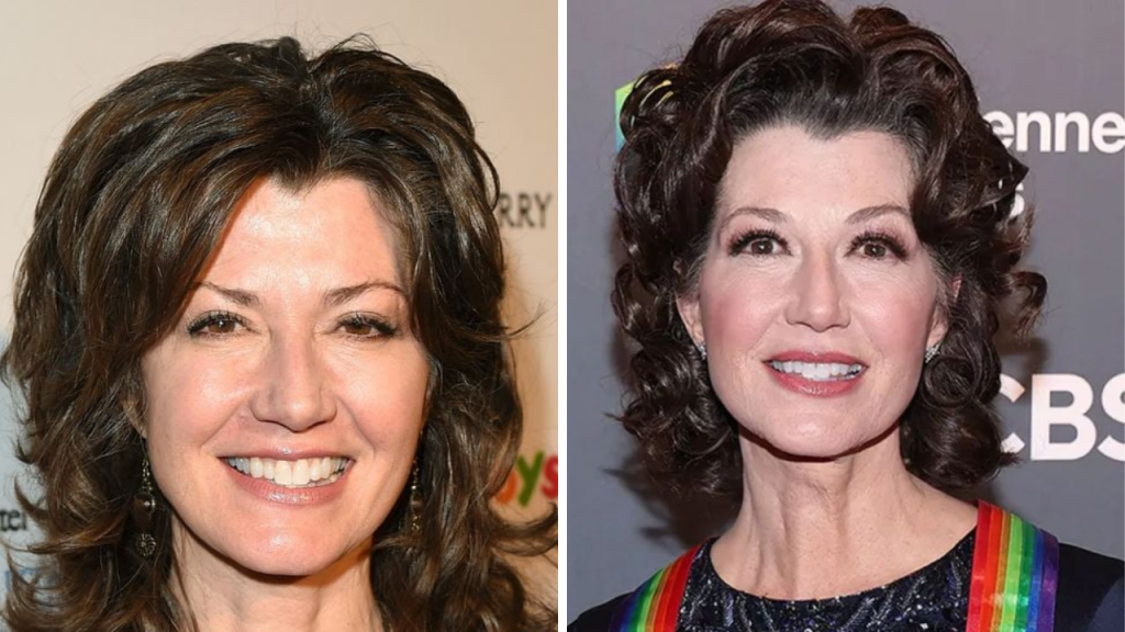 amy grant plastic surgery